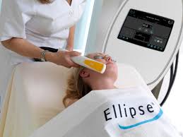 ELLIPSE